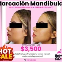 Marcación mandibular